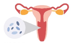 Gardnerella vaginalis